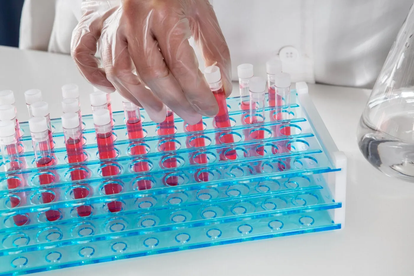 Komplexní laboratorní vyšetření krve
